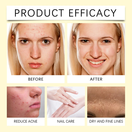 60ml Natural Vitamin E Essential Oil For Massage Skin Care Scraping Shower Face Body Nail Hair Eyelash Care Universal Daily Care